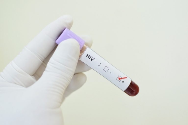 Teste rápido para HIV passa a ser vendido em farmácias do Brasil